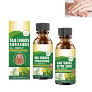 Toenail Fungus Treatment Extra Strength, Nature \u0026 Effective Nail Fungus Treatments for Fingernails \u0026 Toenail - 30ML*2PC